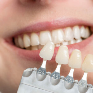 Dental implants