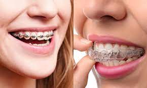 Modern Orthodontic Solutions for a Confident Smile Modern Orthodontic Solutions for a Confident Smile