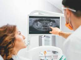 X-Rays For Your Smile: Understanding the Importance of Dental X-Rays