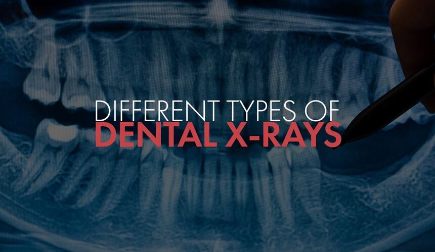 Essential Dental X-Rays: