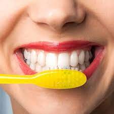 Top 5 Teeth Whitening Habits to Consider