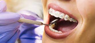 Why Should You Visit a Dentist Before You Travel