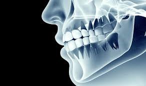 Dental X-rays cost