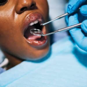 The Importance of Teeth Cleaning and Costs The Importance of Teeth Cleaning and Costs