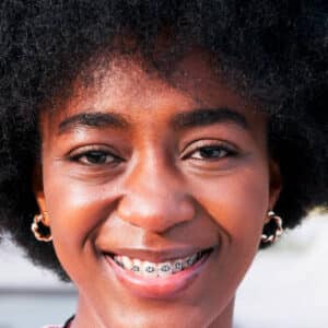 Does Having Braces Change Your Voice? Does Having Braces Change Your Voice?