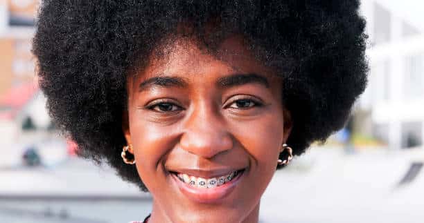 Does Having Braces Change Your Voice? Does Having Braces Change Your Voice?