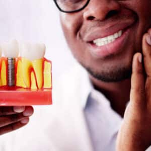 How Long Do Dental Implants Last? How Long Do Dental Implants Last?