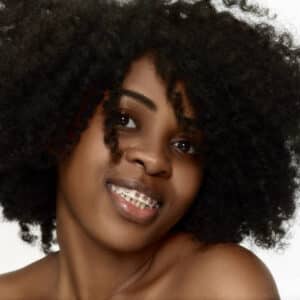 How Much Do Braces Cost in Nairobi, Kenya? How Much Do Braces Cost in Nairobi, Kenya?
