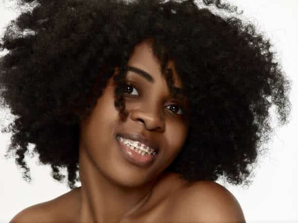 How Much Do Braces Cost in Nairobi, Kenya? How Much Do Braces Cost in Nairobi, Kenya?