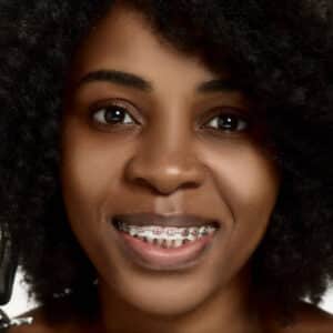 Cost of Dental Braces in Nairobi: What to Expect in 2025 Cost of Dental Braces in Nairobi: What to Expect in 2025