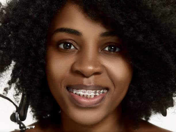 Cost of Dental Braces in Nairobi: What to Expect in 2025 Cost of Dental Braces in Nairobi: What to Expect in 2025
