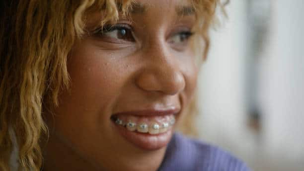 Cost of Dental Braces in Nairobi: What to Expect in 2025