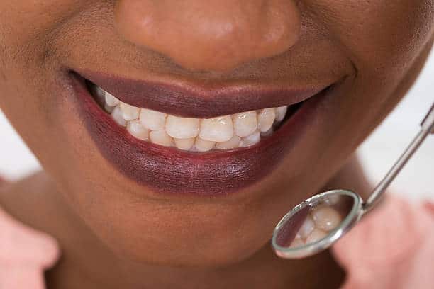 Frequently Asked Questions About Dental Crowns